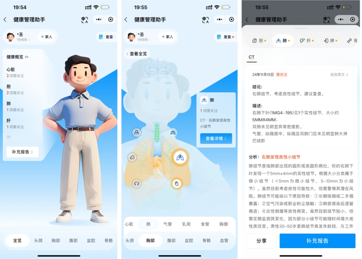 腾讯健康 AI 智能体驱动医疗创新